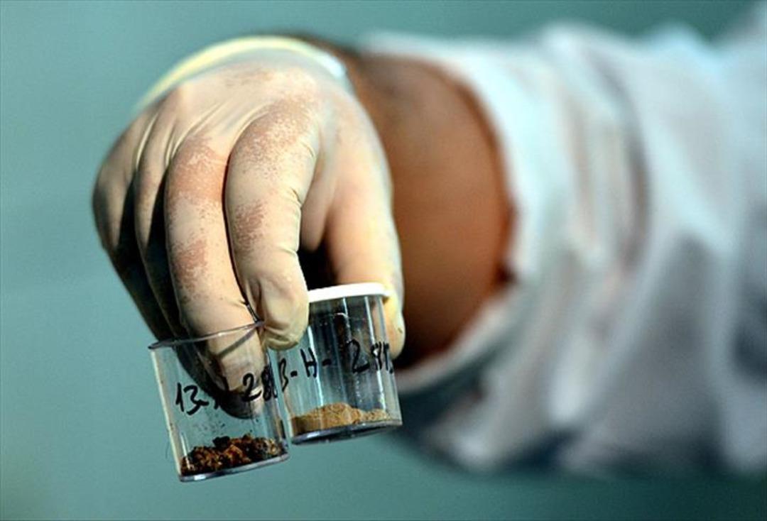 Renalistler sadece yetişkinlerin sorunu değildir: her yaşta görülebilir! Uzmanlar risklerden uyardı ... 2