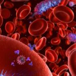 Her 5 ölümden 1’inin sebebi: Sepsis! Kan zehirlenmesi nedir?