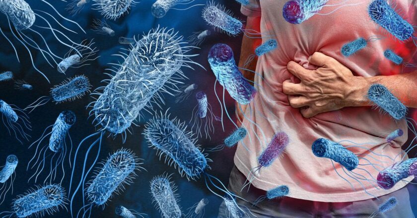 Gıda zehirlenmesi vakaları artıyor! Uzmandan kritik uyarılar: Bu hataları sakın yapmayın!